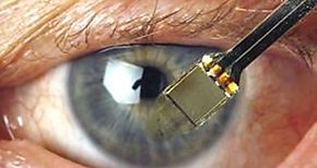 Prueban con xito en humanos trasplante de retina contra la ceguera