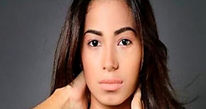 Primera dama conden exclusin de Miss Turismo Panam por vitiligo