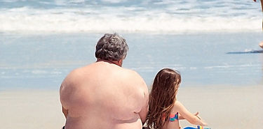 Obesidad genera altas probalidades de desarrollar la forma ms grave de COVID19