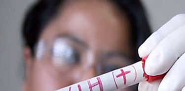 El tratamiento antirretroviral es la mejor prevencin contra el VIH