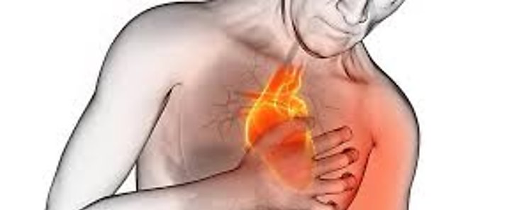 Desarrollan sistema de alerta temprana para infarto de miocardio basado en IA