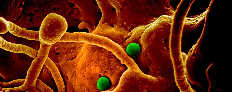 Coronavirus puede infectar tejido cerebral y afectar memoria y lenguaje revela estudio brasileo