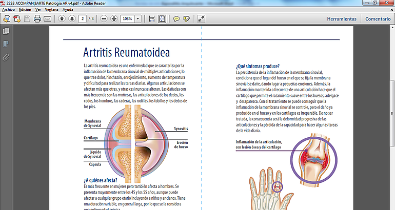 artristis