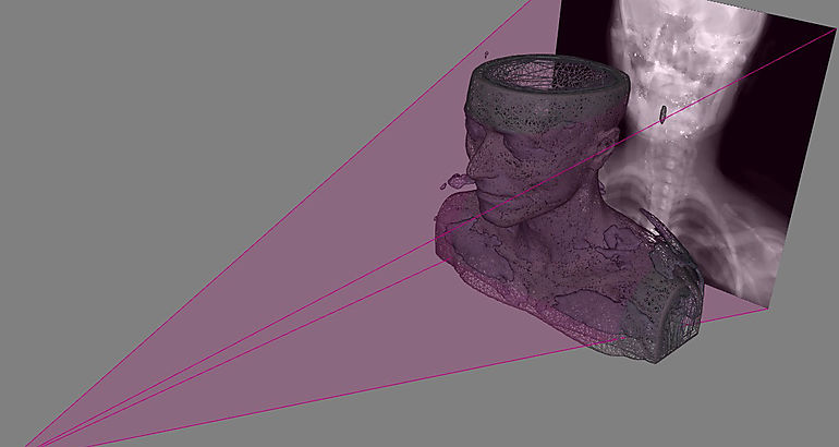 Imgenes en 3D a partir de radiografas 