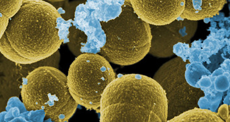 Microorganismo Staphylococus aureus