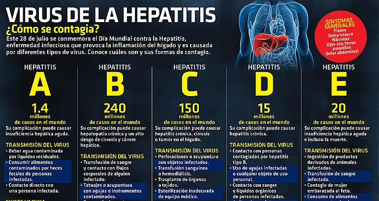 hepatitis